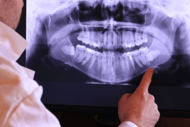 Best Orthodontic Emergency Dentist in Odenton, MD