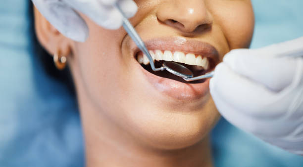 Best Emergency Dentist for Knocked-Out Tooth in Odenton, MD